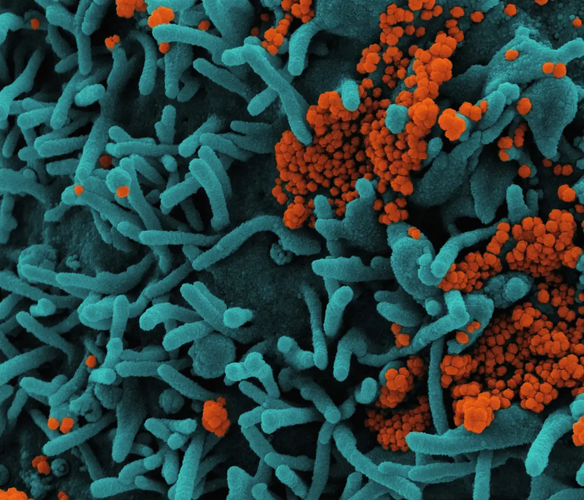 Coloured scanning electron microscopy of gut bacteria showing the diversity of microbial species in the human intestinal microbiome